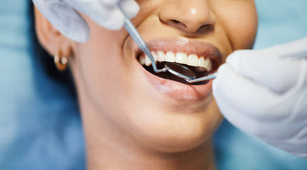 Best Urgent Tooth Repair  in Rtez, CO